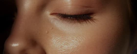 Skin Analysis